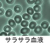 1月の血液サラサラドロドロチェックのご案内