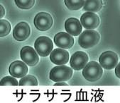 【講師活動】血流チェック＆10月の血液サラサラドロドロチェック日のご案内