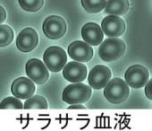 【講師活動】血流チェック＆10月の血液サラサラドロドロチェック日のご案内